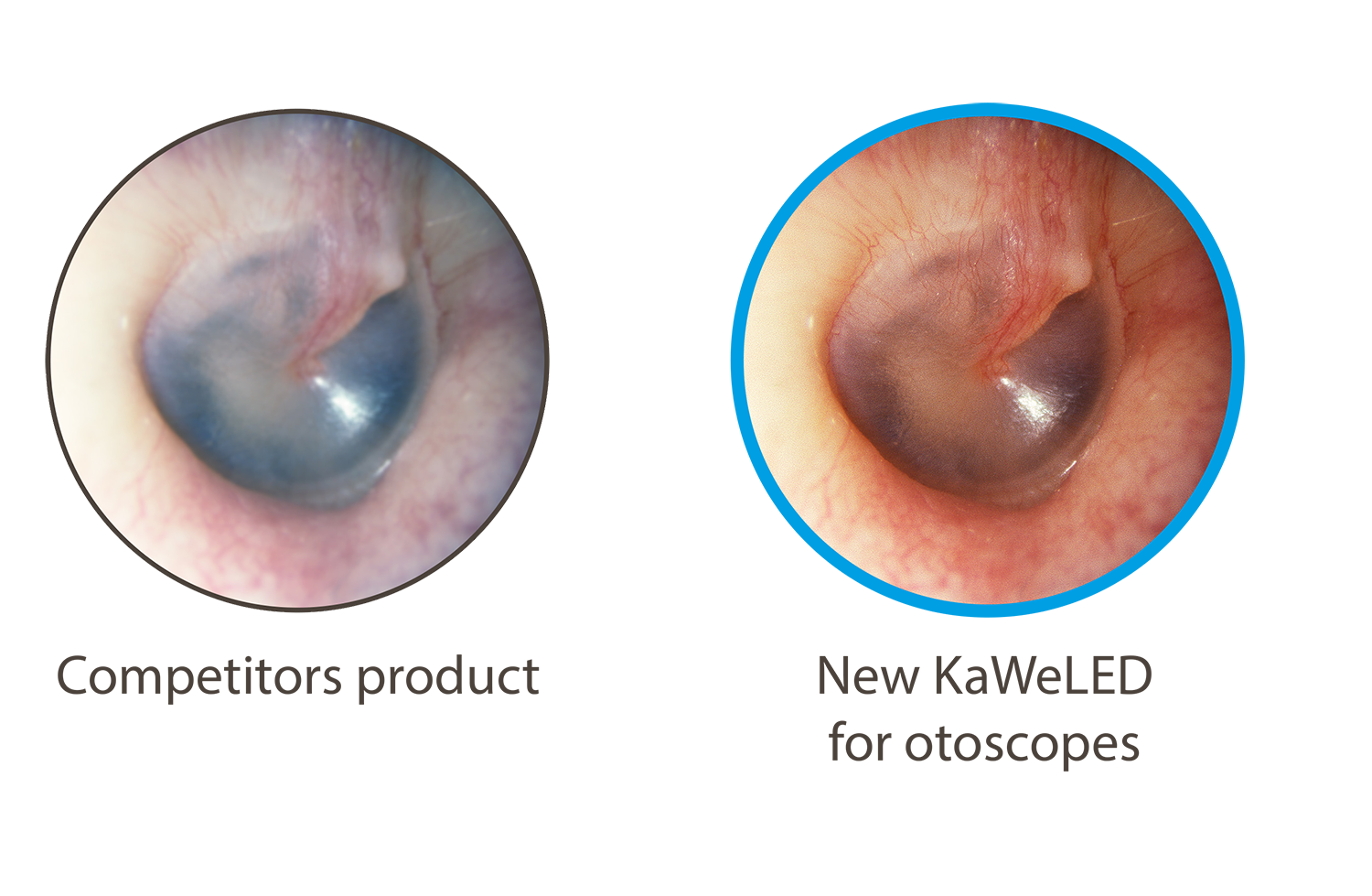 KaWeLED light sources: the best standard for quality diagnostics